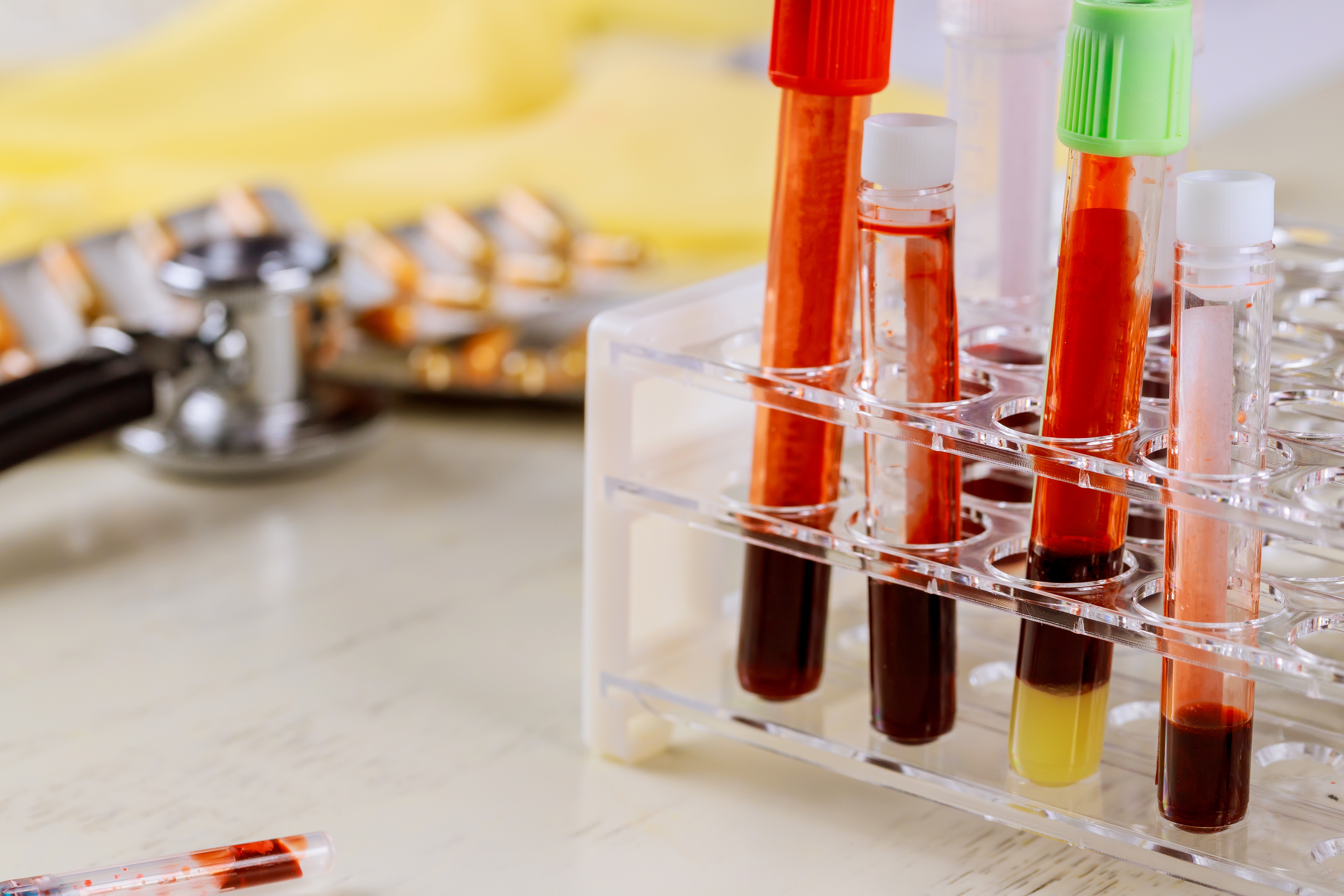 clinical blood samples
